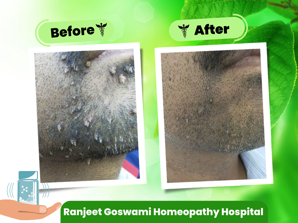 Acupressure Clinic in Ghaziabad