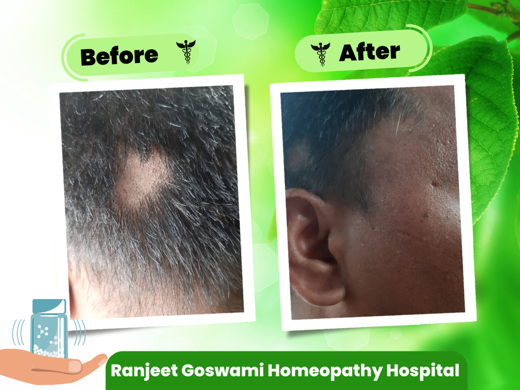 Acupressure Clinic in Ghaziabad